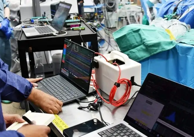 Paradromics impianta il suo primo BCI umano e sfida Neuralink