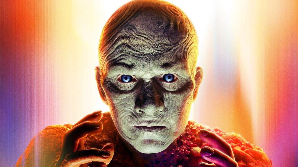 Superman star Anthony Carrigan says alopecia is his superpower
