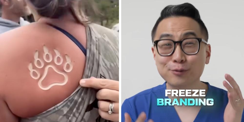 “I’ll just get a tattoo, thanks”: What is freeze branding? New body mod trend hits TikTok