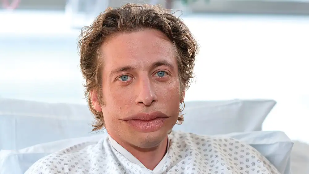 Jeremy Allen White Undergoes Experimental Mouth Enlargement Surgery