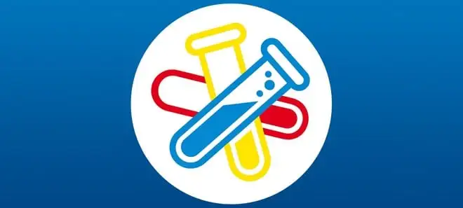 Fritz!Box 7590 AX, 7590 e 7530, in rollout nuovo aggiornamento beta