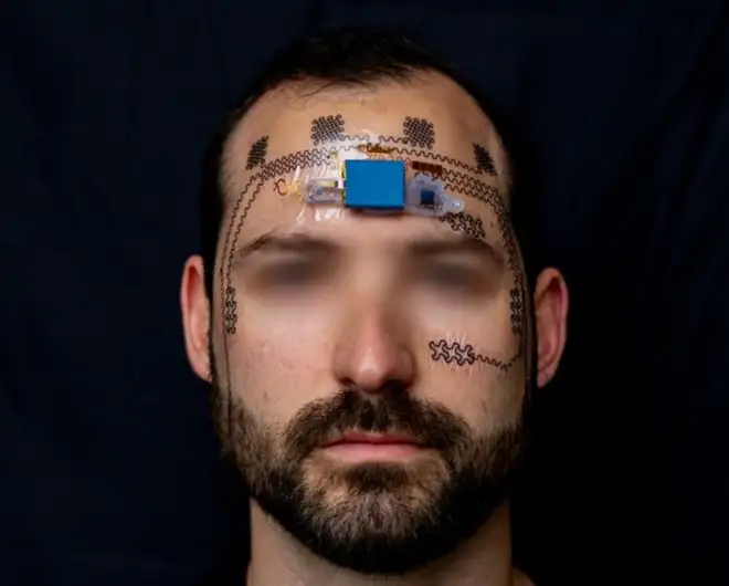 Un cerotto elettronico sulla fronte potrà monitorare lo stress mentale