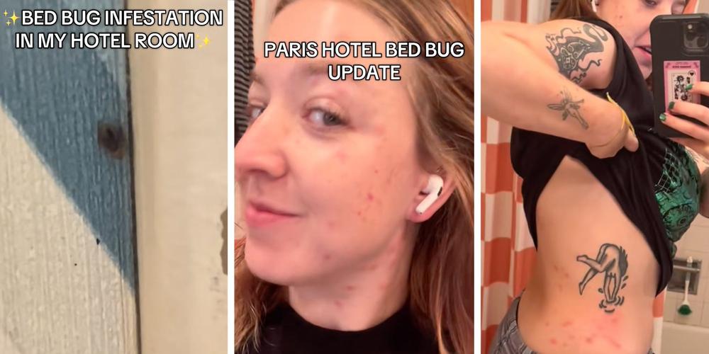 “You REALLY need to call the airline”: Woman stays in Paris hotel crawling with bedbugs, then flies home