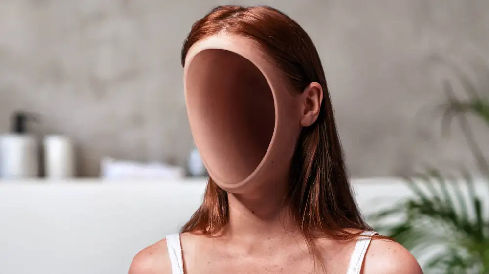 Dissolving Fillers Leave Face Completely Concave