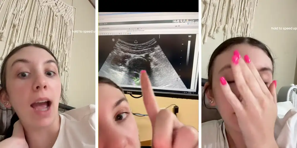 “What is this?”: Woman has a C-section while giving birth. Now she says something was left inside her