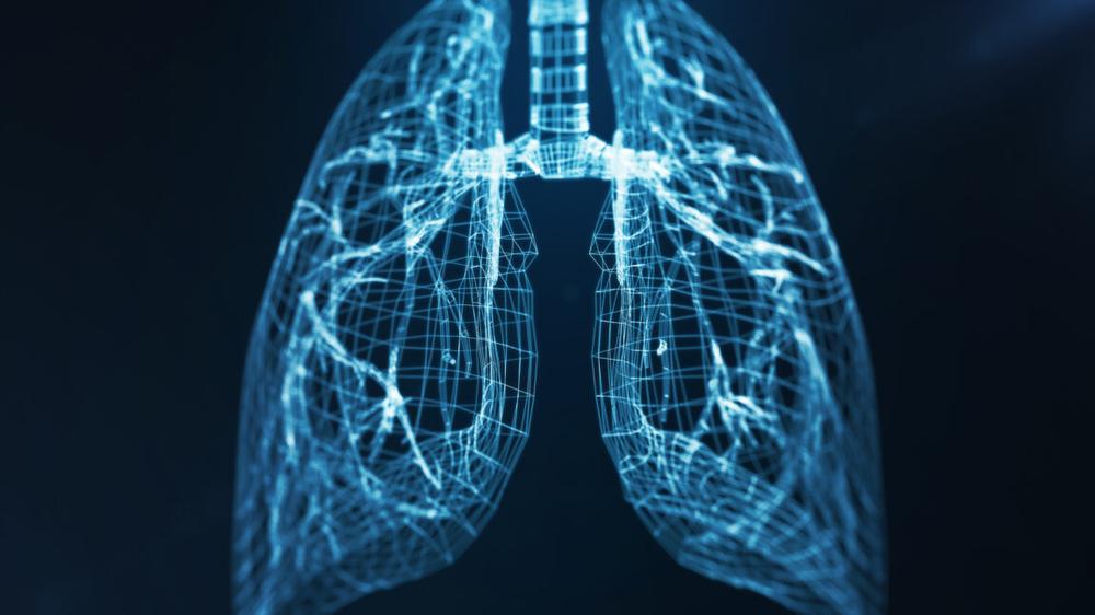 Custom machine kept man alive without lungs for 48 hours