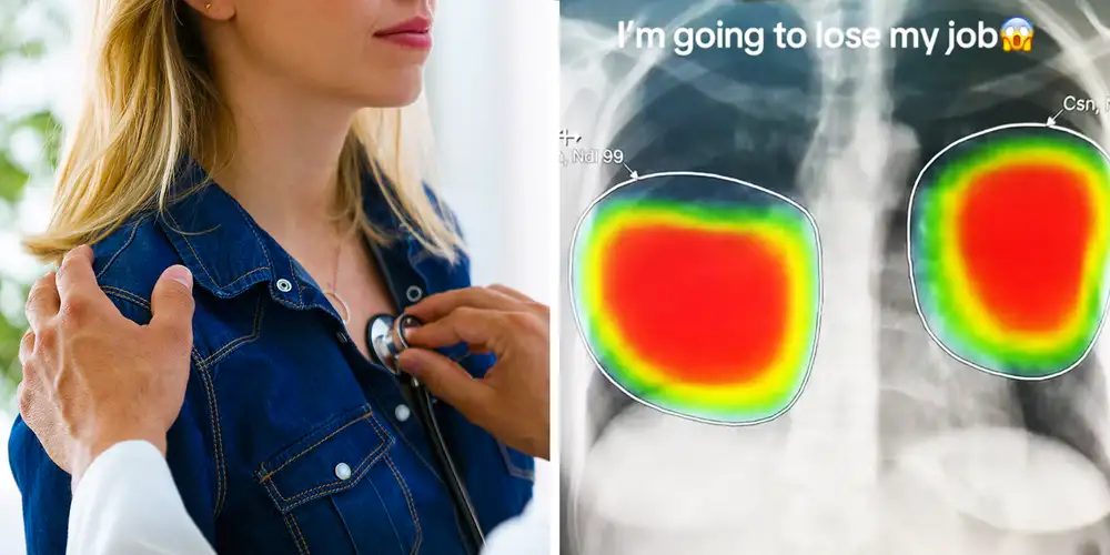 Pulmonologist illustrates exactly why he’s concerned that AI will take his job, sparking debate
