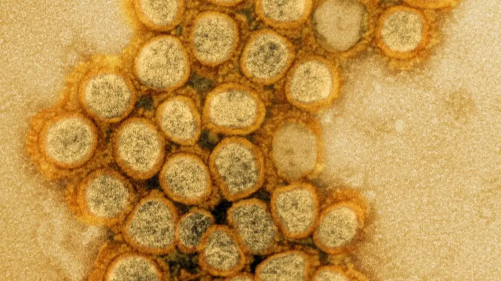 New COVID variant swiftly gains ground in US; concern looms for summer wave