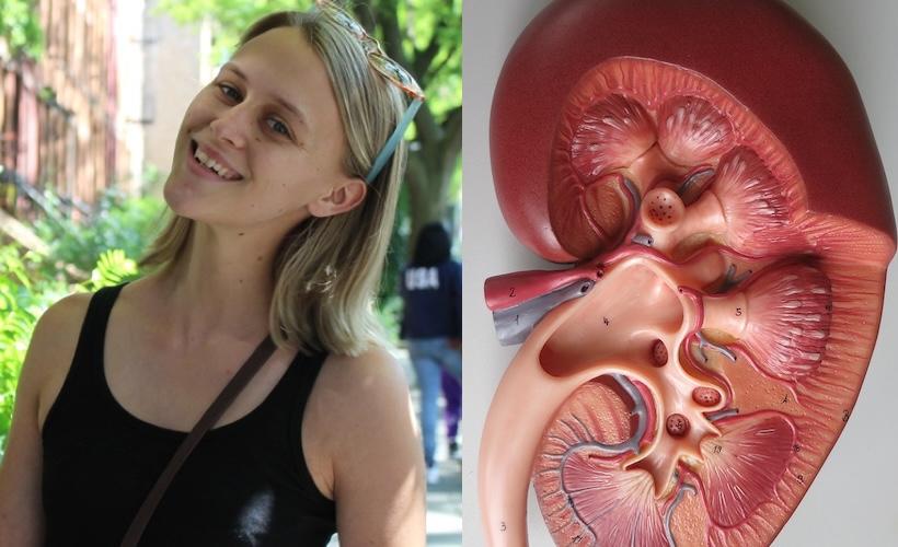 Yes! This Kidney Is Woman-Owned