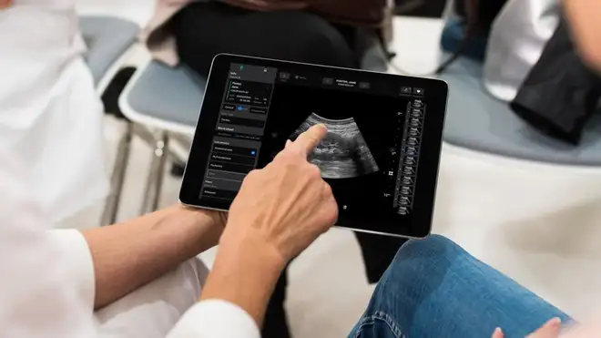 Samsung punta su Exo: 100 milioni per la startup che rivoluziona la medicina