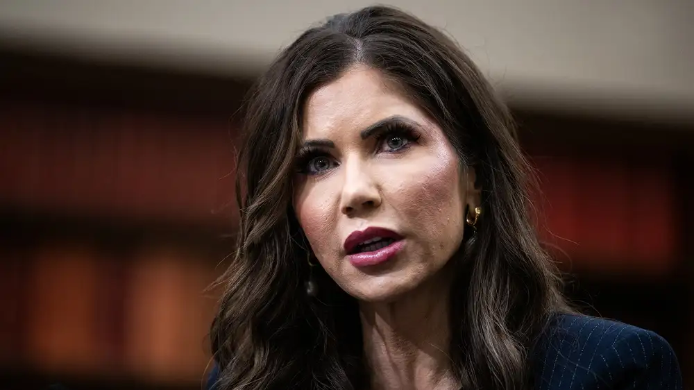 Allergic Swelling Leaves Kristi Noem’s Face Completely Recognizable