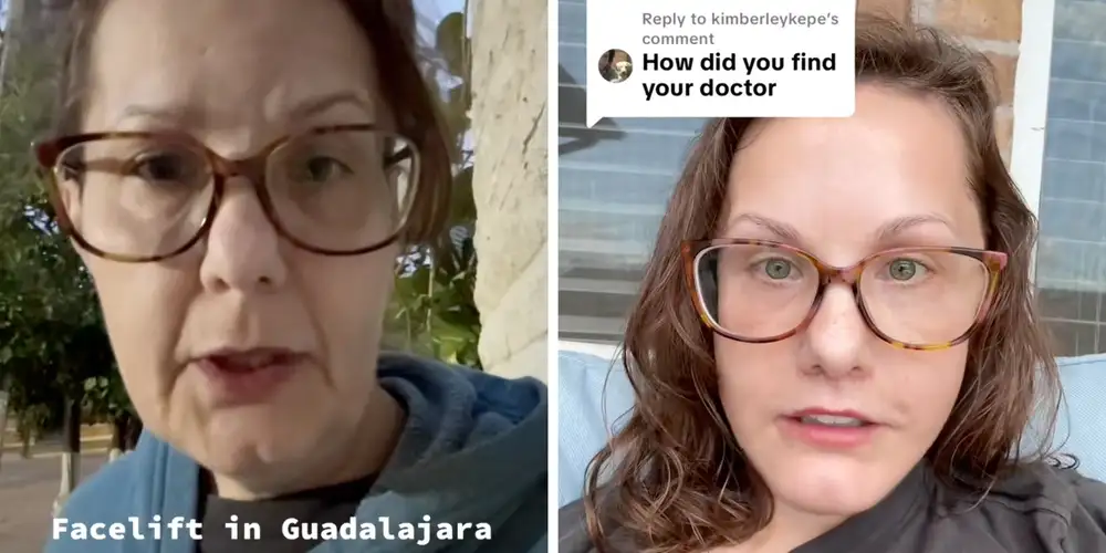 People are obsessed (and a bit unsettled) by this 50-year-old woman’s viral facelift