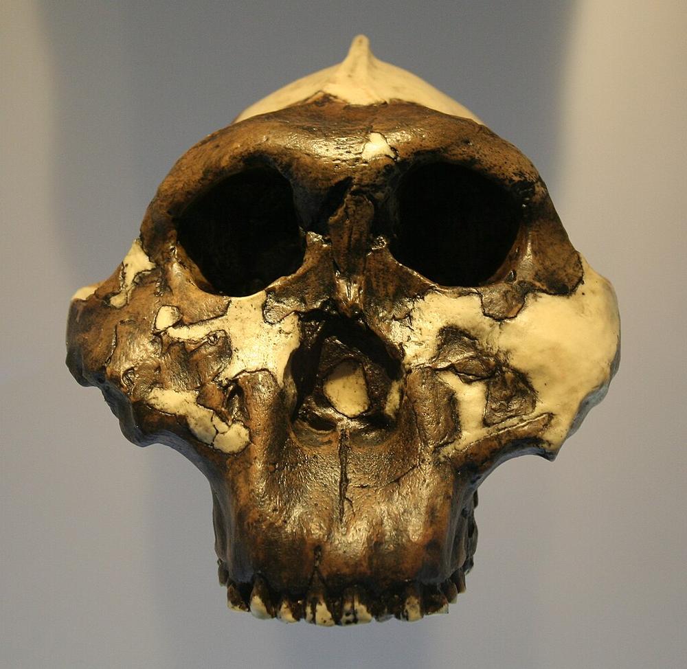 Lead poisoning has been a feature of our evolution