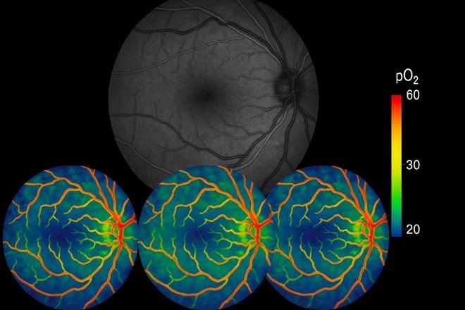 Nuova tecnologia svela i segreti della retina prima che la vista svanisca