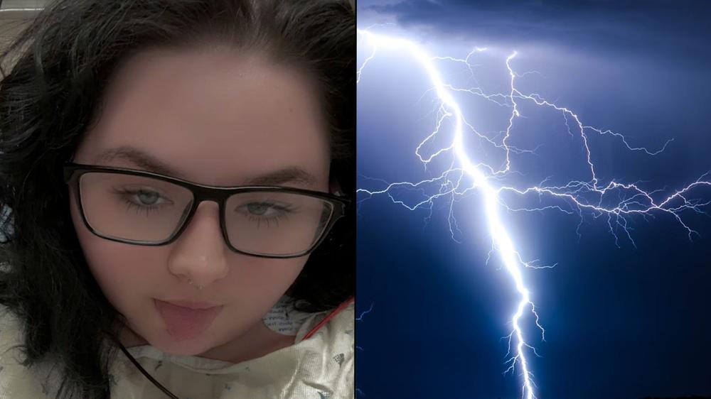 Woman struck by lightning because she was on Instagram “lucky” to be alive