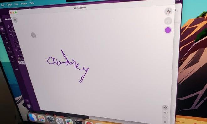 Neuralink: scrive con il pensiero dopo 20 anni grazie al chip di Elon Musk