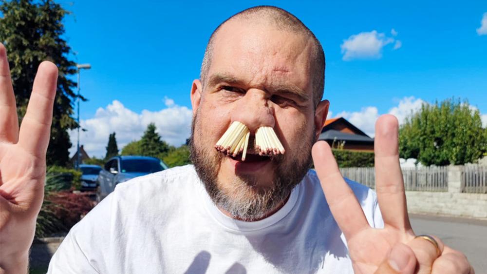 Dad breaks Guinness World Record after sticking 81 matches in his nose to impress his kids